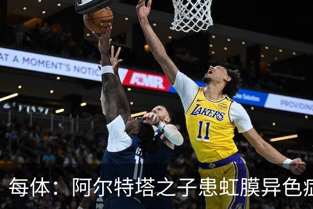 每体：阿尔特塔之子患虹膜异色症，已完成18岁以下梯队首秀